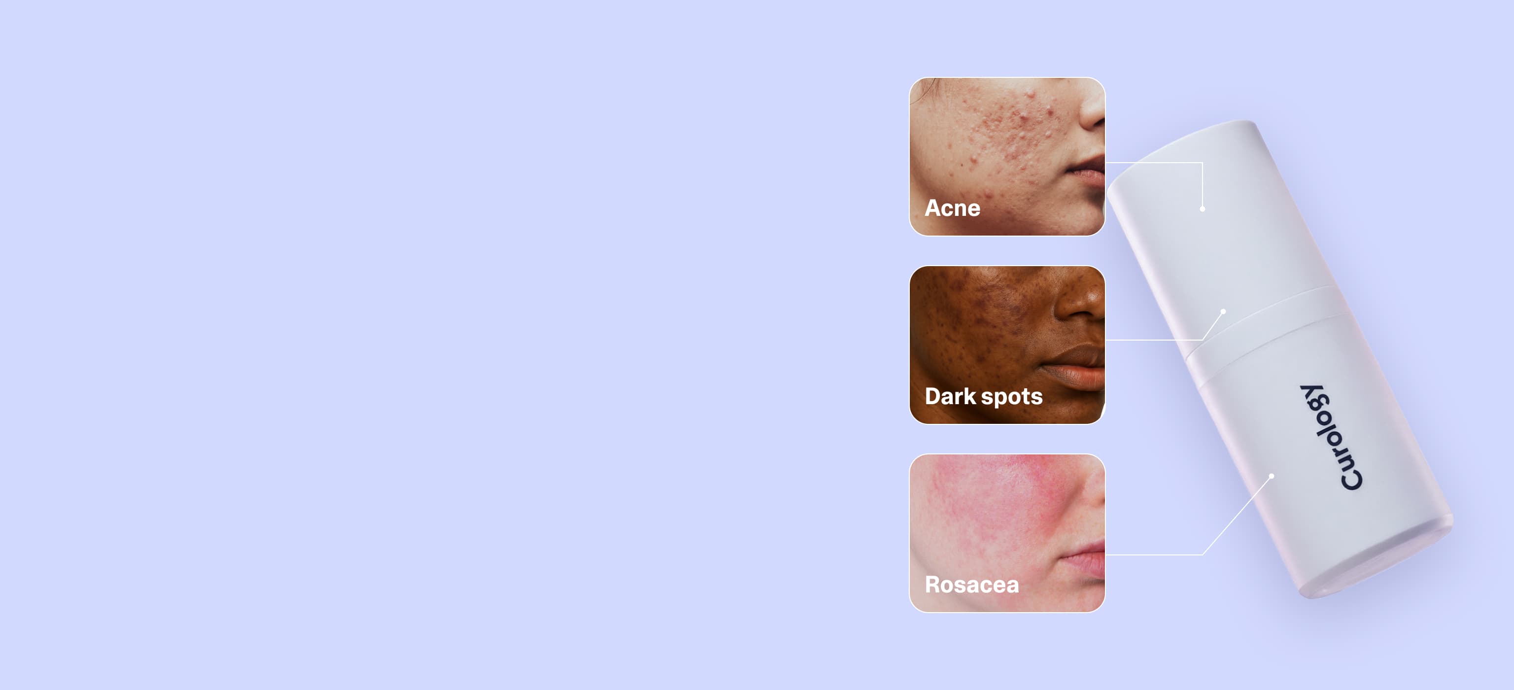 Skin concerns that can be treated with a Curology custom formula - desktop