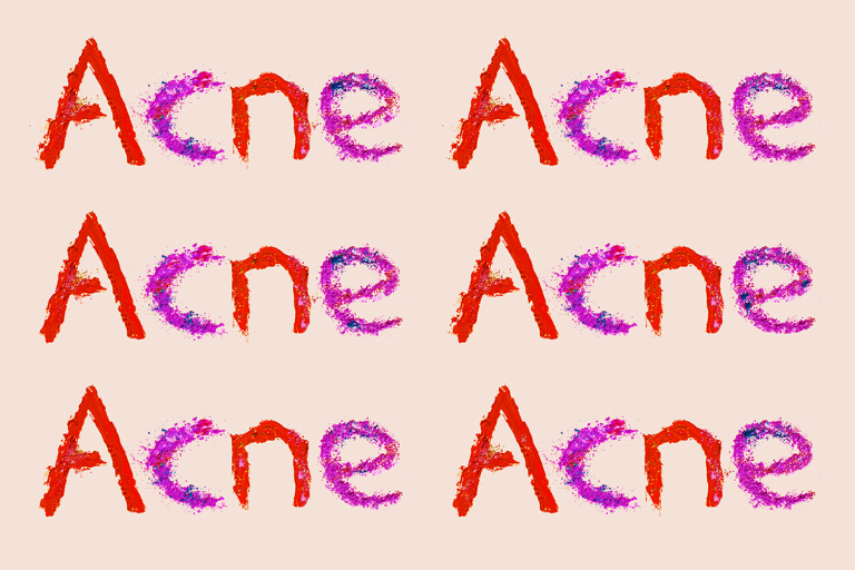 "Acne" six times in red and purple letter against a pale pink background