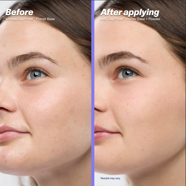 Before-and-after of skin after applying DayPrime Rx;. Curology dermatology providers say the primer base gives an instant blurring effect while prescription actives work over time.