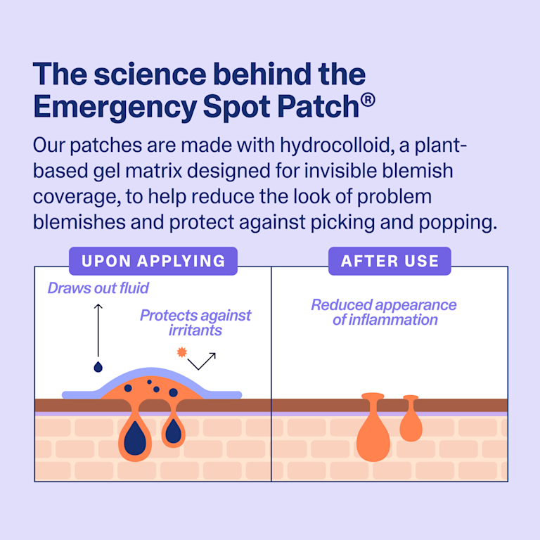 science behind the Curology Emergency Spot Patch