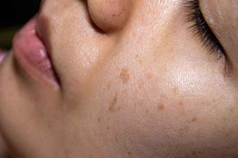 close up of woman with freckles on her face