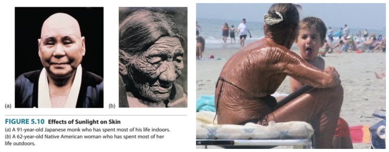 Right side image shows sun damage effects over the years on a 92-yr-old man. Left side image shows woman with apparent sun damage on her body at the beach.