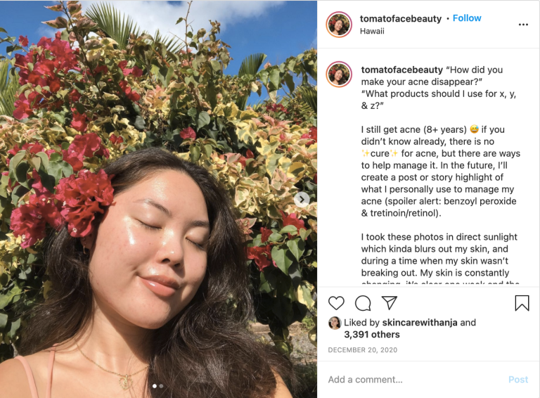 Instagram photo of woman with flower in her hair