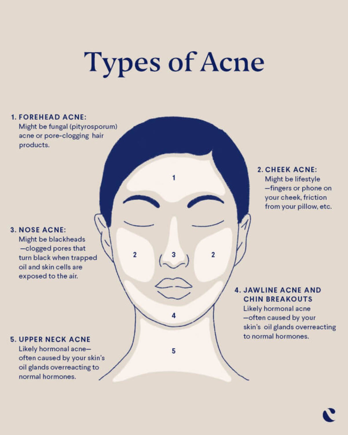 Types of Acne