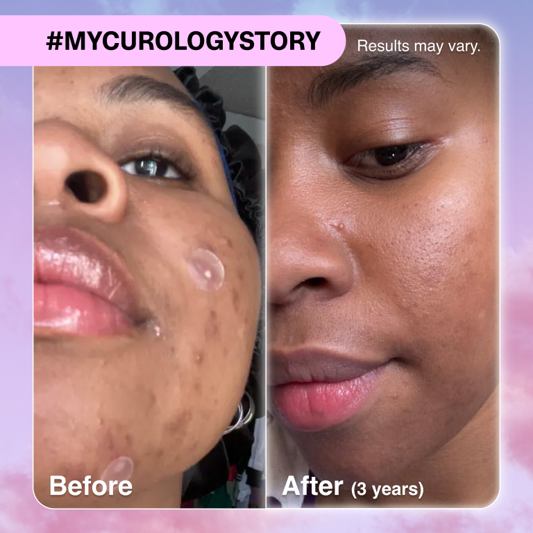 Sherin B&A