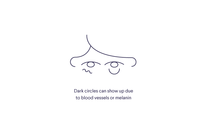 Illustration of the upper half of a face, including eyes and dark circles. Text reads: "Dark circles can show up due to blood vessels or melanin"
