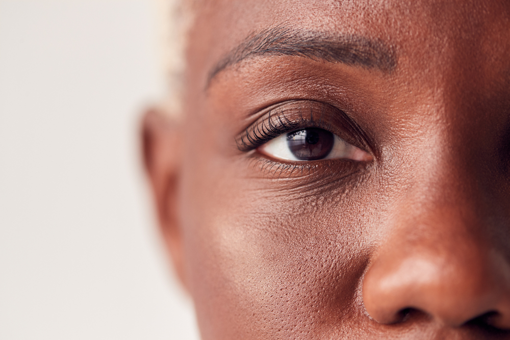 Stryx  Dark Circles Under Eyes Men  Causes  Treatments