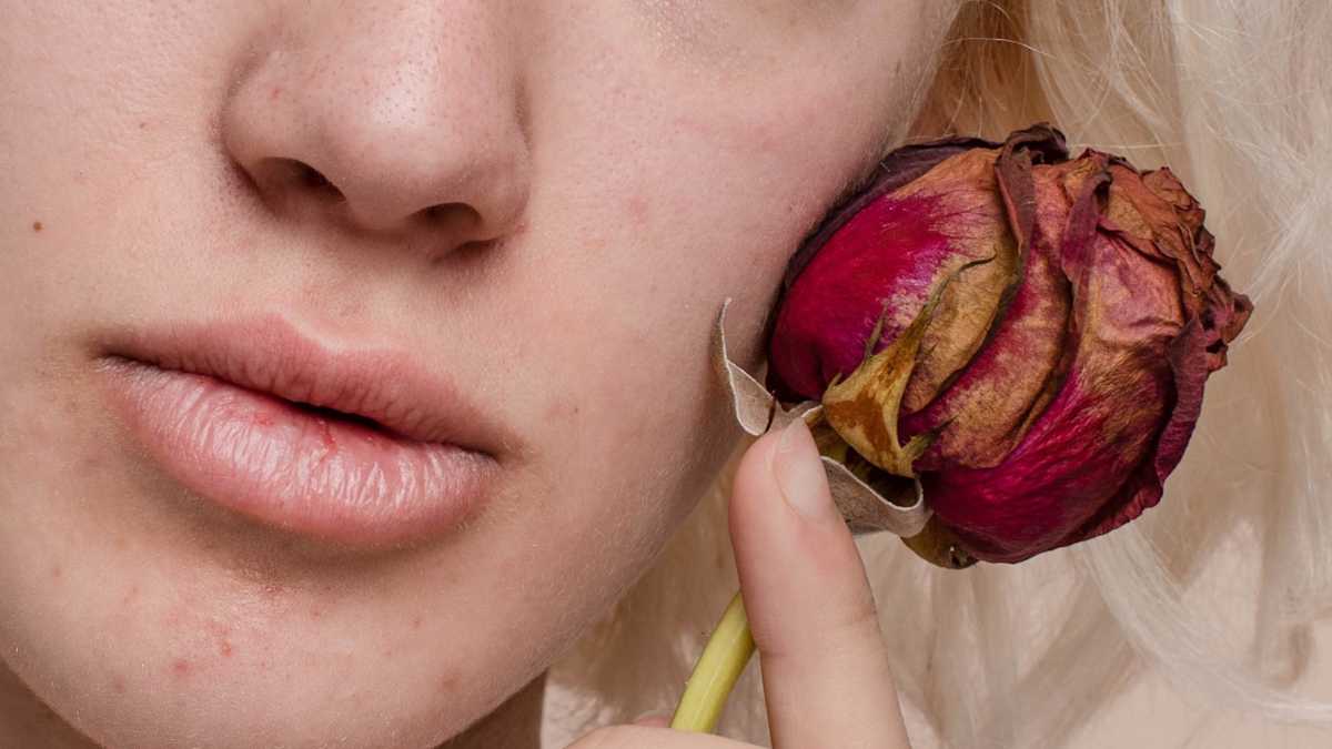 How To Use Rosehip Oil In Skincare By Stephanie Papanikolas Curolo