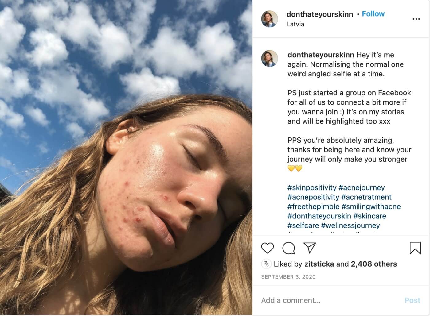 Instagram photo of woman with eyes closed