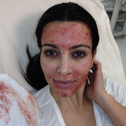 Kim Kardashian instagram photo after micro needling procedure