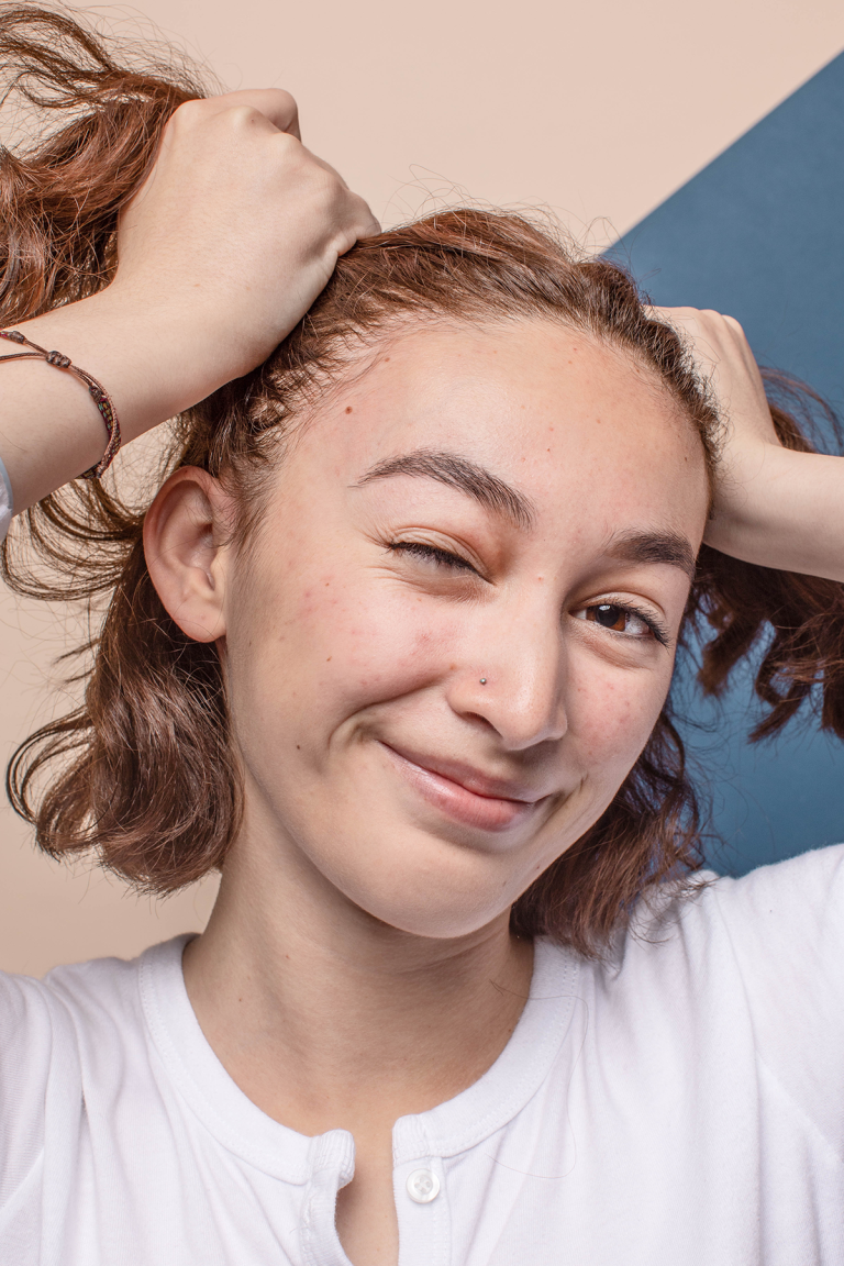 Woman holding hair and winking teen acne