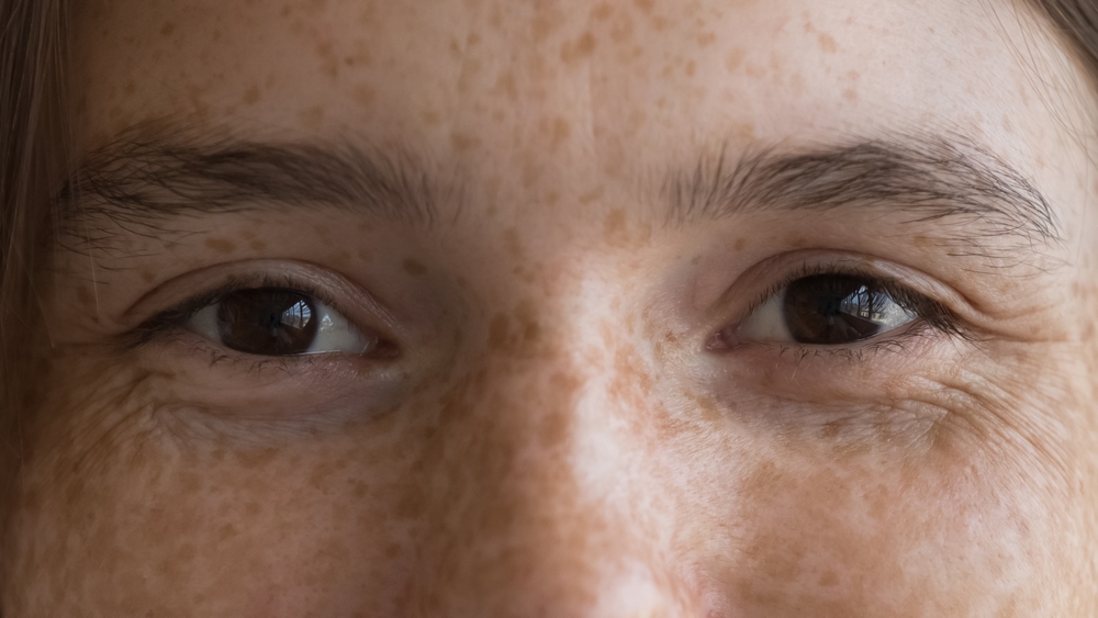 freckled young woman portrait