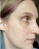 Melissa - After