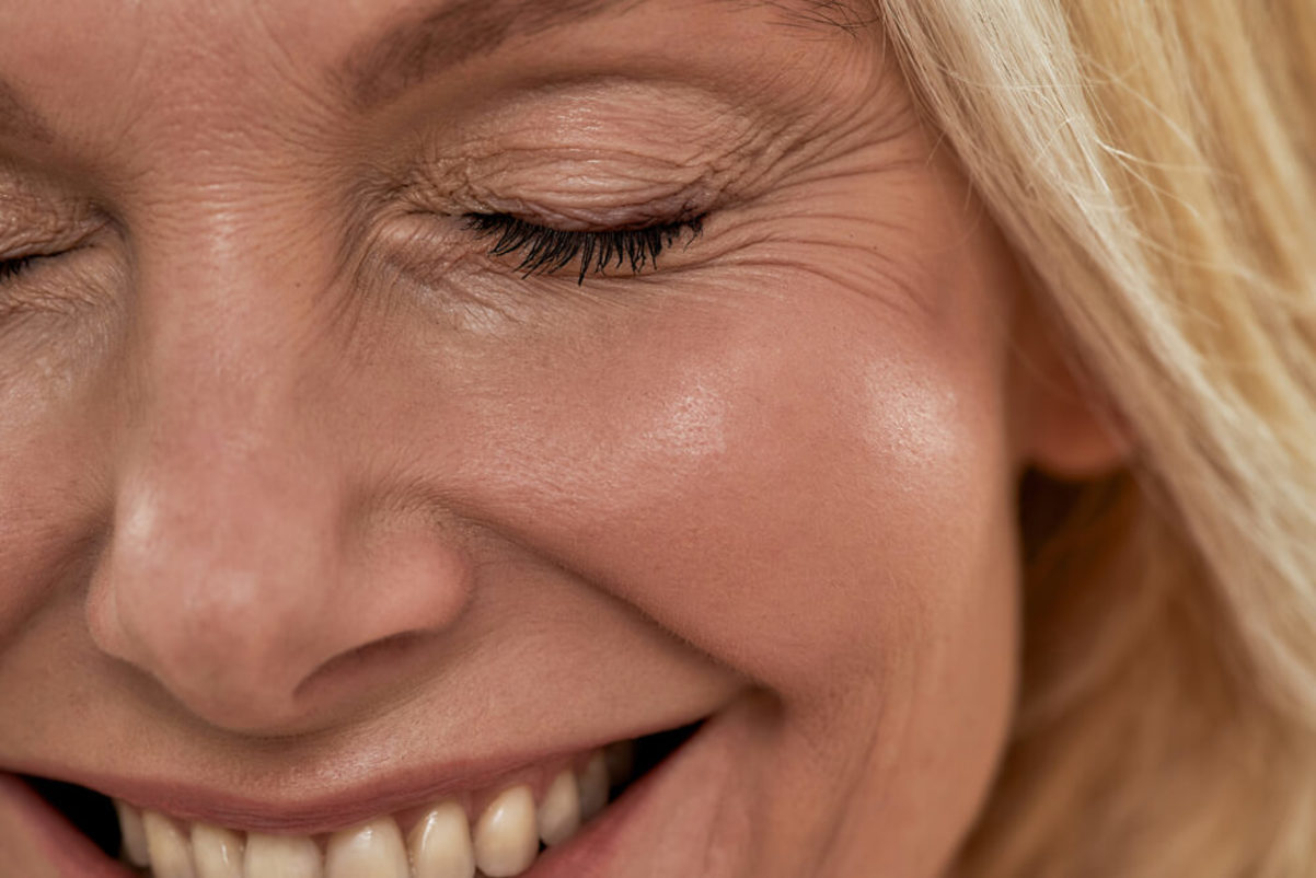 Smiling Woman with Eye Wrinkles