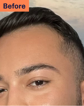 Nori Before Hair Loss