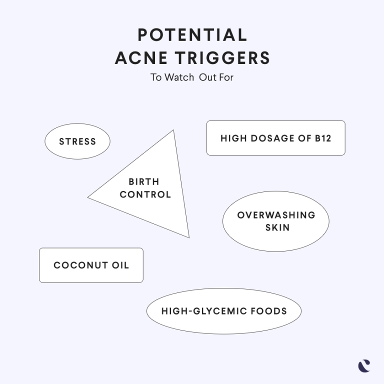 What triggers acne breakouts? 