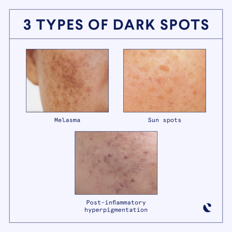 Red spots on skin: causes, treatment and when to worry