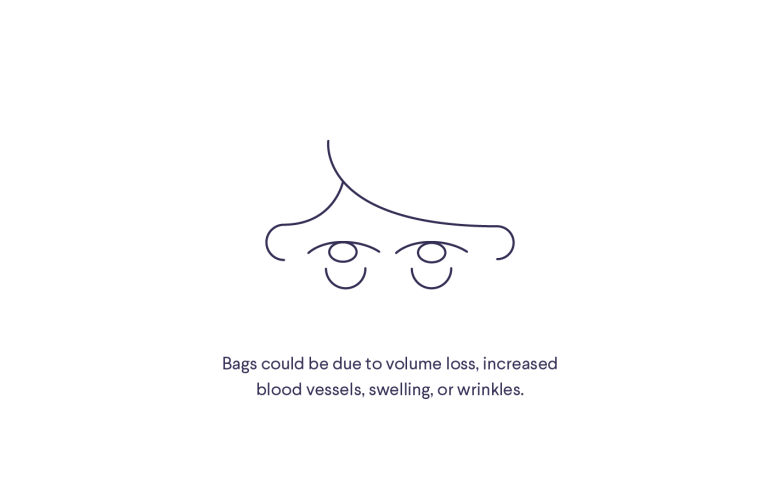 Illustration of eyes and undereye bags with text "Bags could be due to volume loss, increased blood vessels, swelling, or wrinkles"