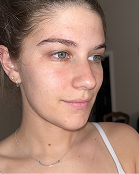 Lauren - After
