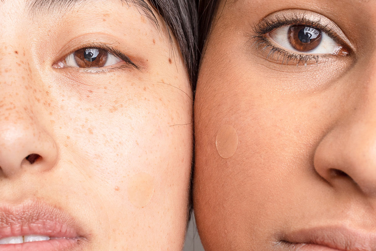 Closeup of two faces with emergency spot patches