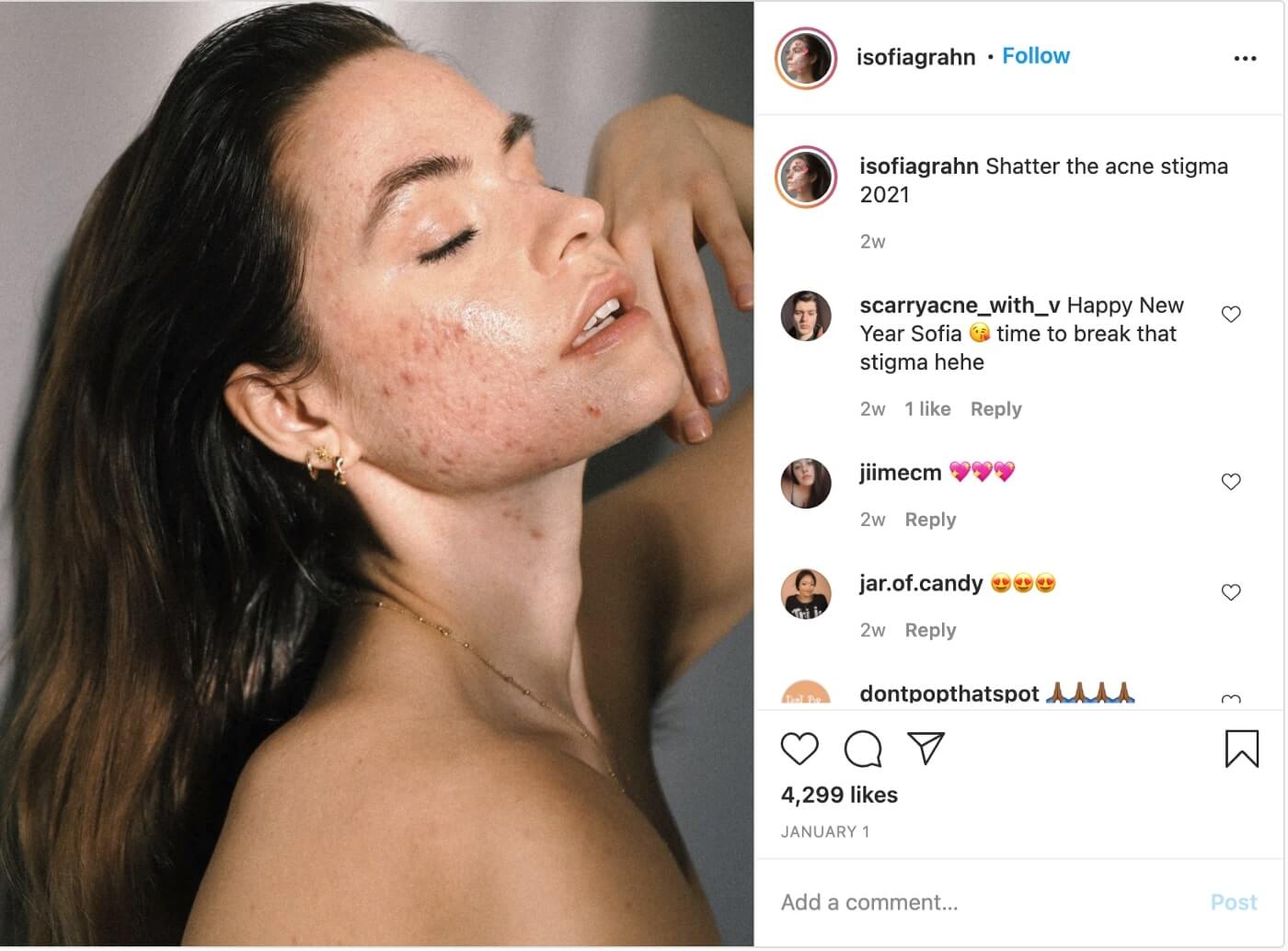 Instagram photo of woman looking up