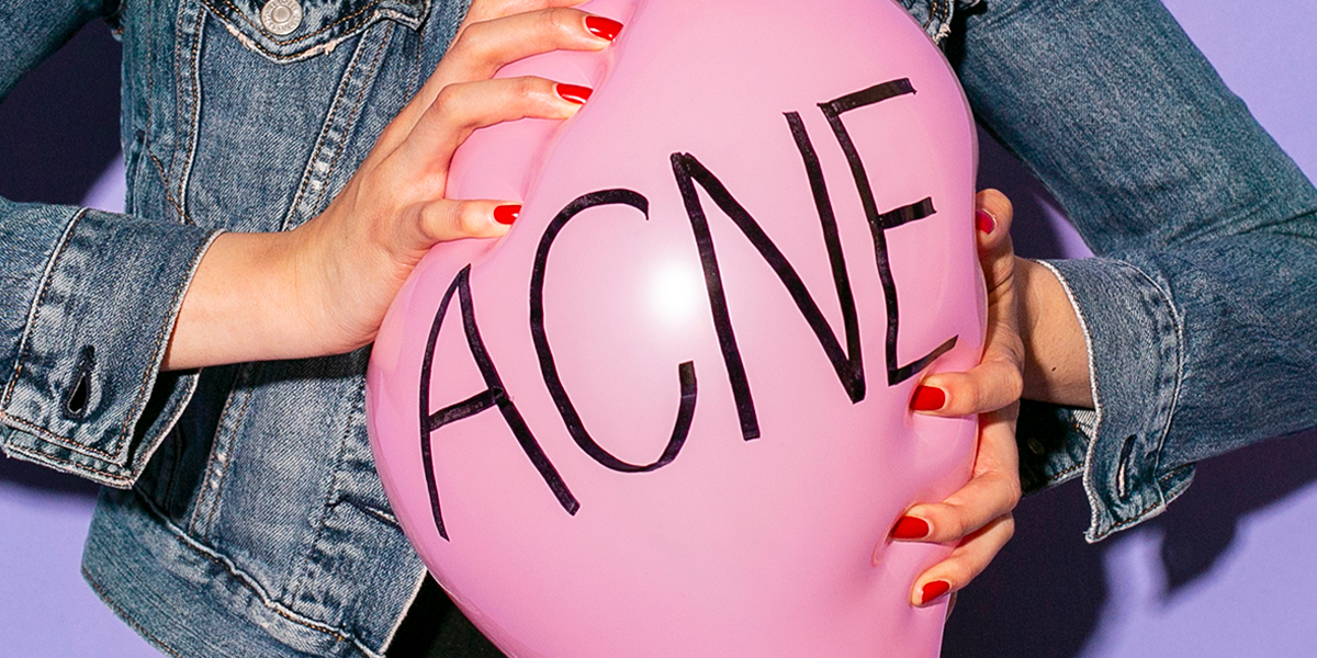 Person in denim jacket and red nail polish squeezing pink balloon with black text "Acne" against a purple background