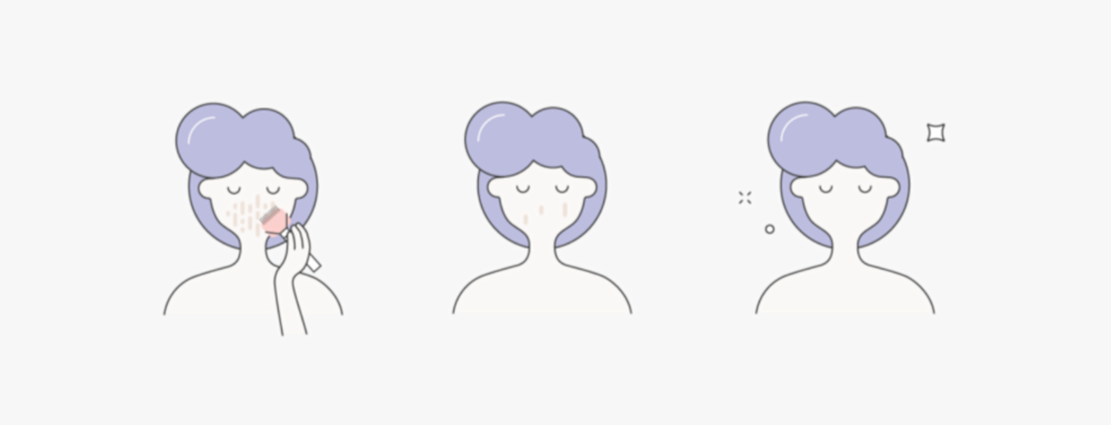 Graphic of 3 people with purple hair clearing acne from their skin