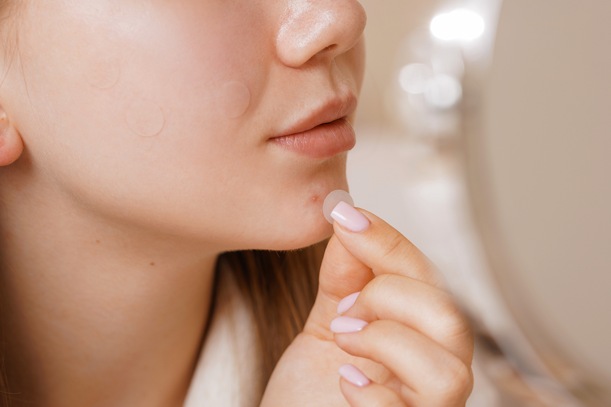 Applying pimple patch