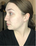 Audra - Before