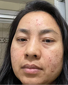 Mu - Before