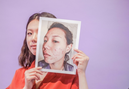 Before and after photo person holding photo | Hana Lee (Instagram: @hanaylee)