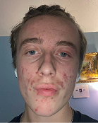 Mark - Before