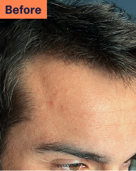 Jordan Before Hair Loss