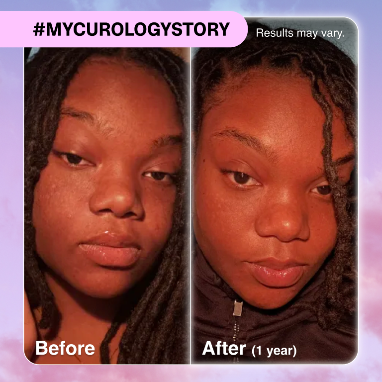 Courtney B&A
