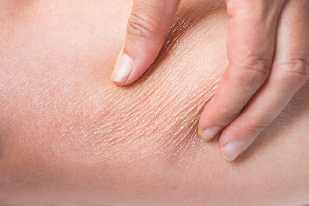 How to improve dehydrated skin, according to the experts - female hand shows calf skin dehydrated