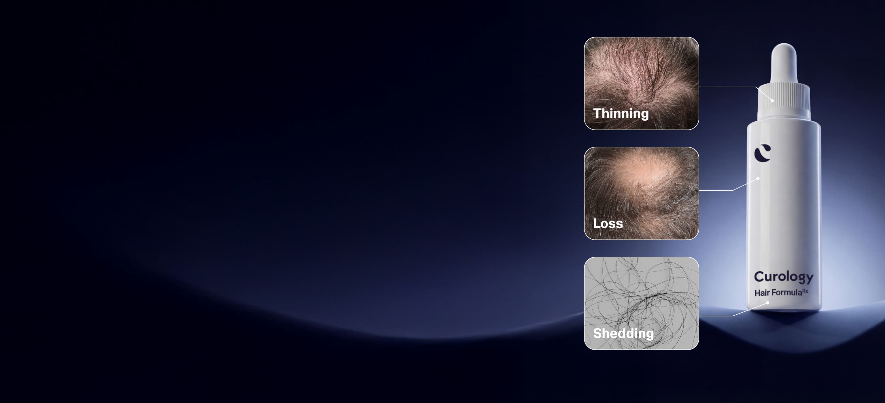 Hair Loss Formula Loss Desktop