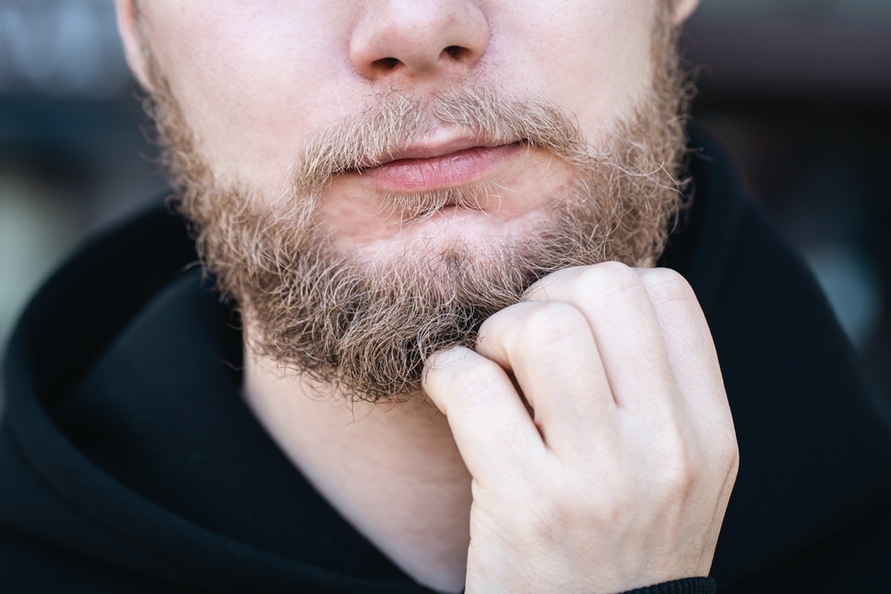 Young man touching his beard - How to treat dry skin under your beard