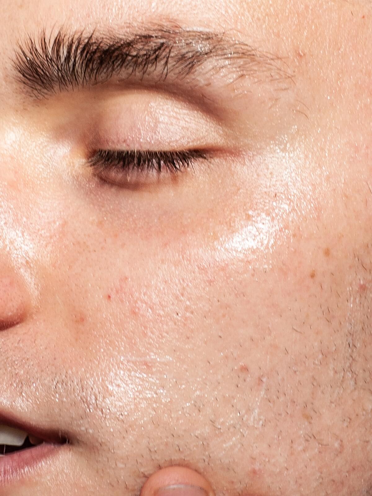 Closeup of mans face with finger on his face