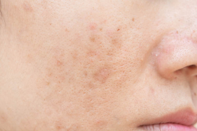 dark spots wrinkles skinconcerns