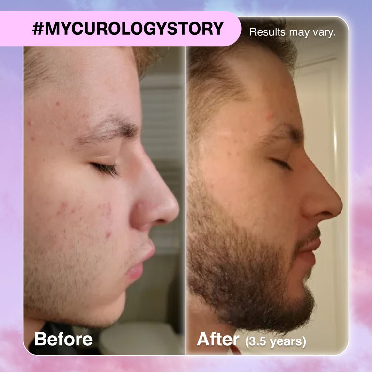 Trevor B&A