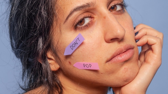 Woman with sticky note on face saying "Don't Pop" pointing at pimple