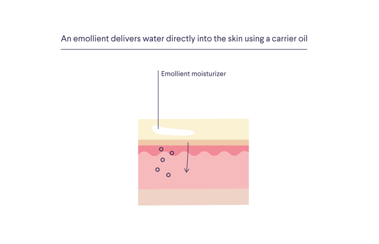 Illustrated diagram showing how emollients work. Text reads, "An emollient delivers water directly into the skin using a carrier oil." Illustration shows an emollient moisturizer sitting on top of the dermis. An arrow points into the skin to show water being pulled in.