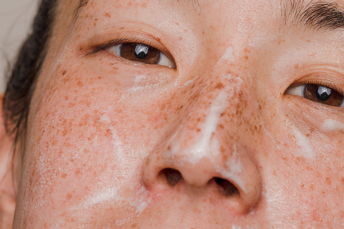 Closeup of a face with cream on it