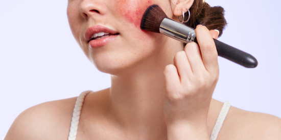 Woman applying makeup to cover rosacea - rosacea tips from the experts