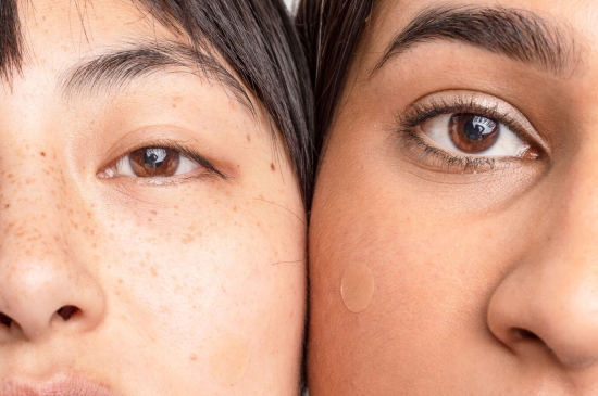 Closeup of two people and their eyes and spot patches