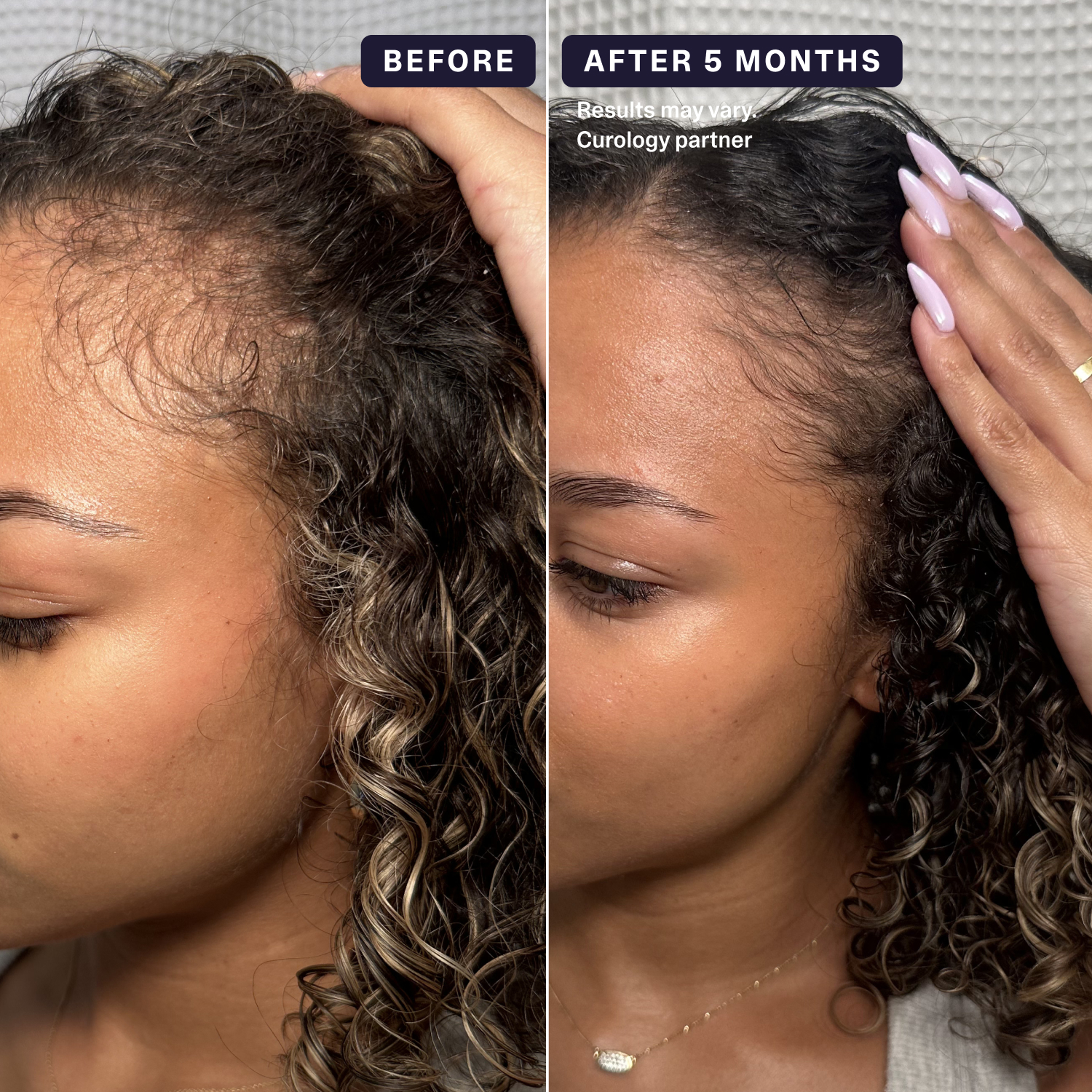 curology-hair-formula-rx-image-5