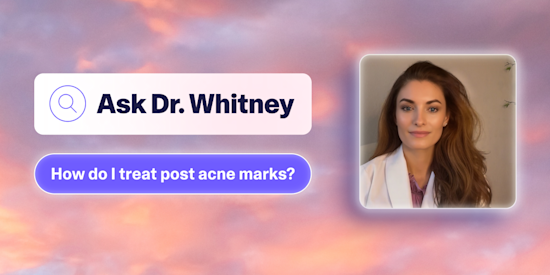 blog post 3 header