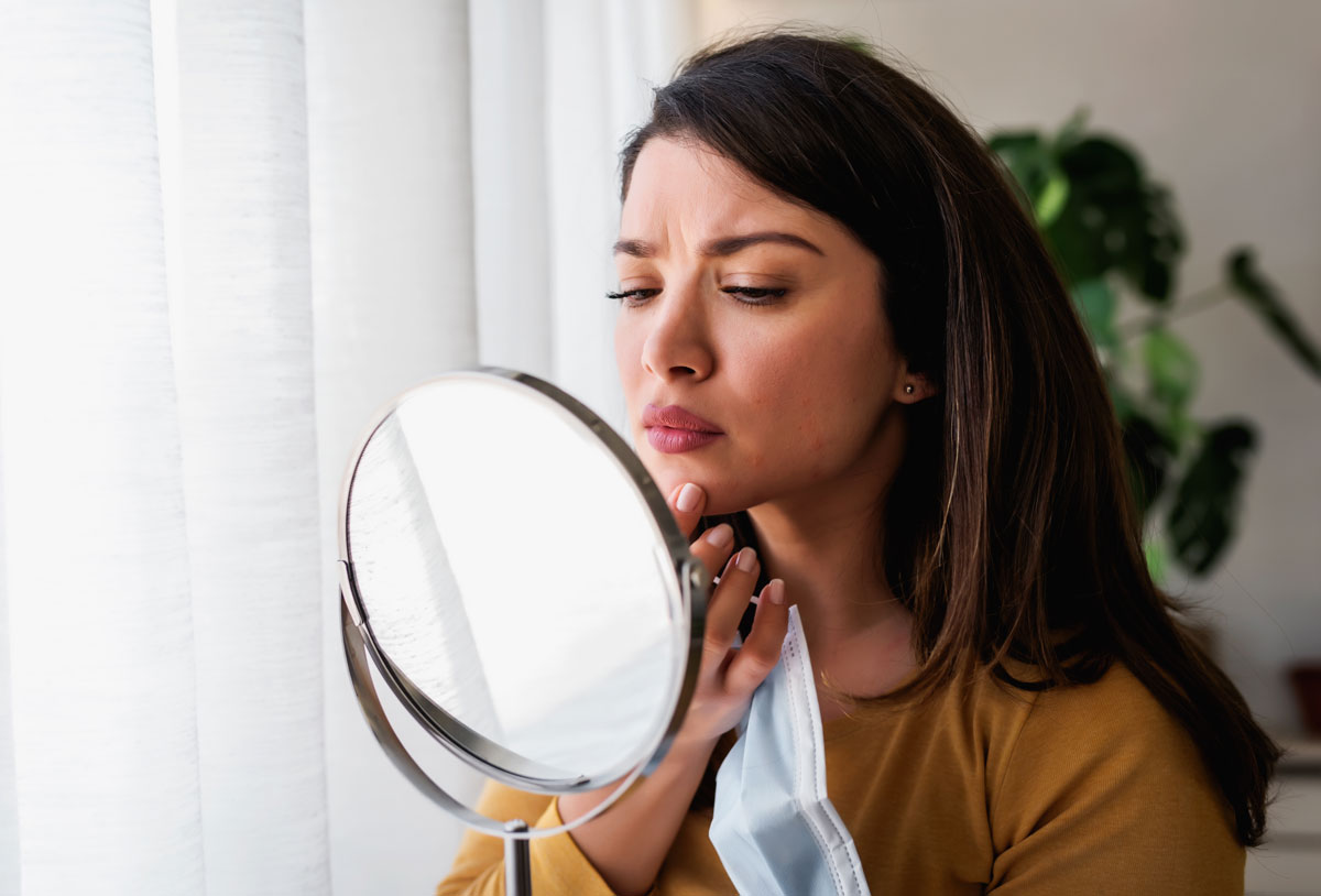 Acne-around-mouth-cause-by-acne-mechanica-mask-acne