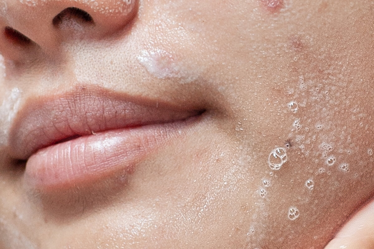 Closeup of the lower left side of a face, wet and lathered with cleanser. 