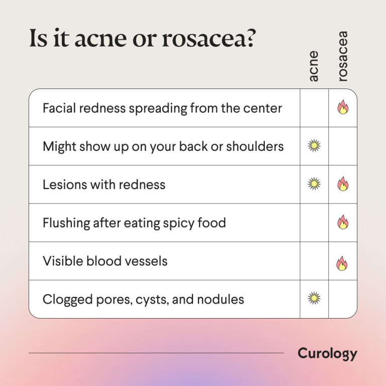 acne vs. rosacea questionnaire